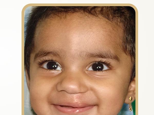 11000 இலவச அறுவை சிகிச்சை