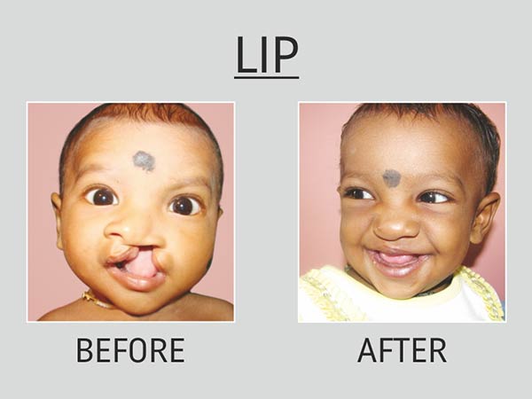 இலவச அறுவை சிகிச்சைகள்