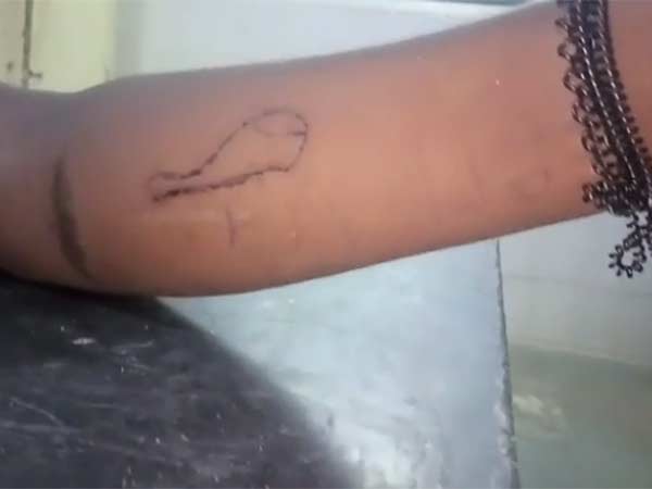 குண்டூசிகளில் குத்து... குண்டூசிகளில் குத்து...