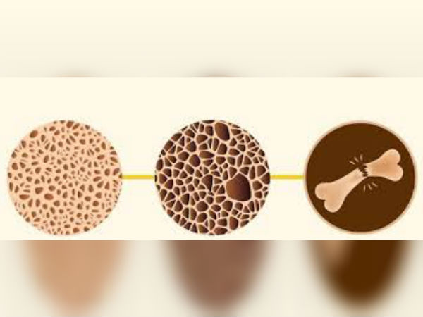 மூலநூல்களில் காணப்படும் வாதநோய்க்கான கிரக சேர்க்கைகள்: