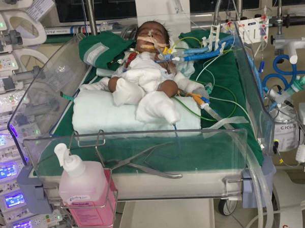 This 60-Day-Old Boy Needs Funds To Survive 