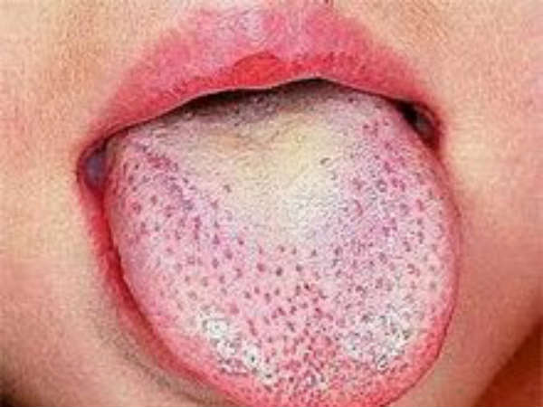 மீண்டும் 