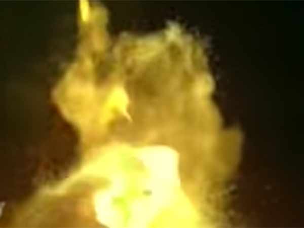 உடையில் பற்றிய தீ