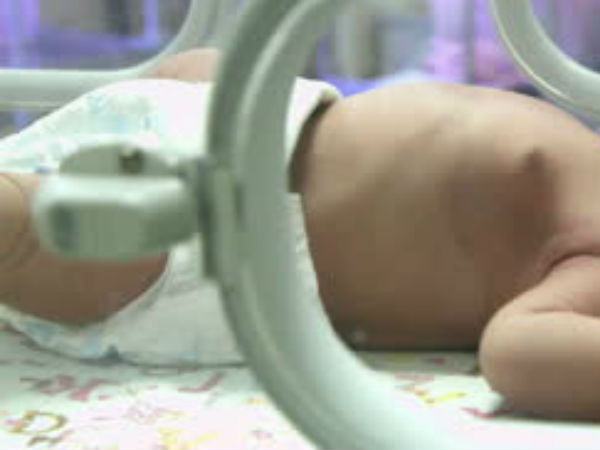 இறந்து போன குழந்தை 