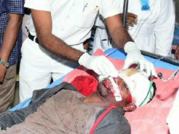 200 பேர் காயம் 