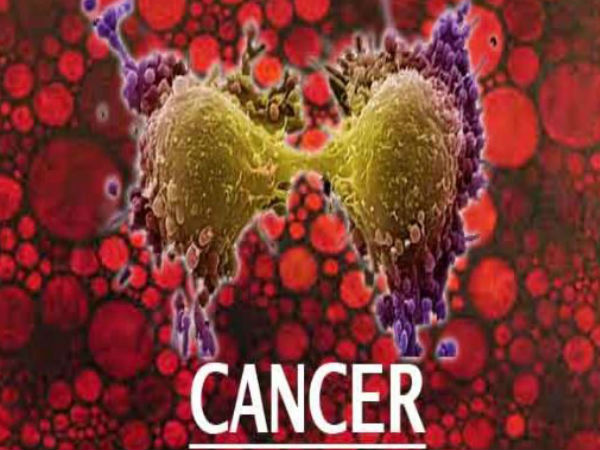 Modern treatment awaits for Cancer patients at KKR hospital Modern treatment awaits for Cancer patients at KKR hospital