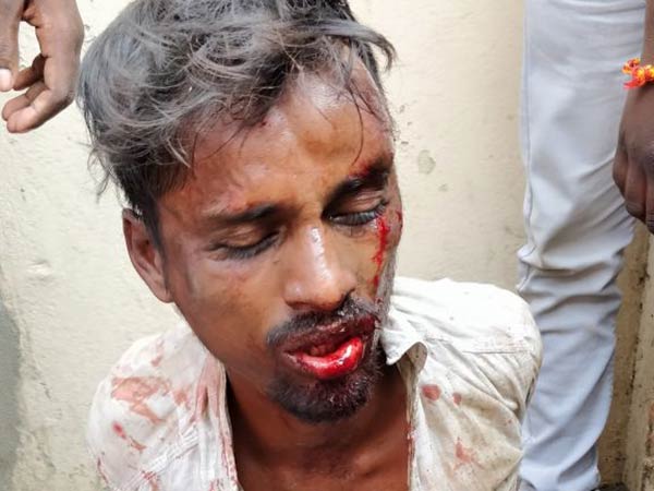 ஜாமீனில் வெளியே வந்த இளைஞர் 