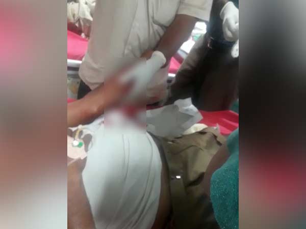 போலீஸ்க்கு அரிவாள் வெட்டு 