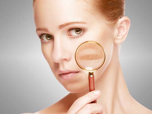 முகசுருக்கம் நீங்க பரிகாரம் 