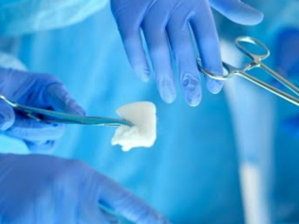 மொத்தமாக மாற்றினார்கள் 