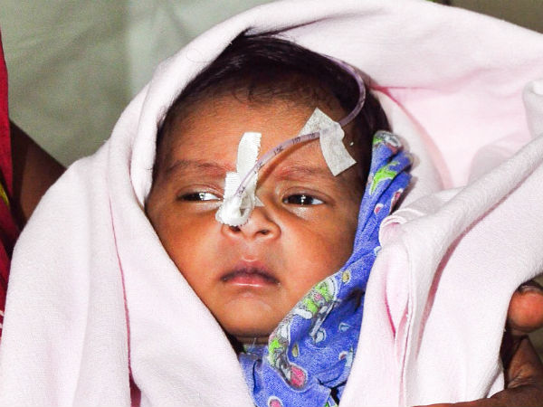 1-month-old daughter of a daily wage worker needs an urgent heart surgery 