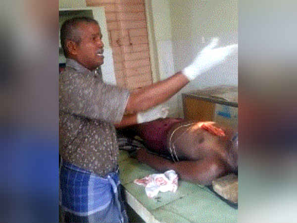 சாக்குமூட்டை போன்றா தைப்பது 