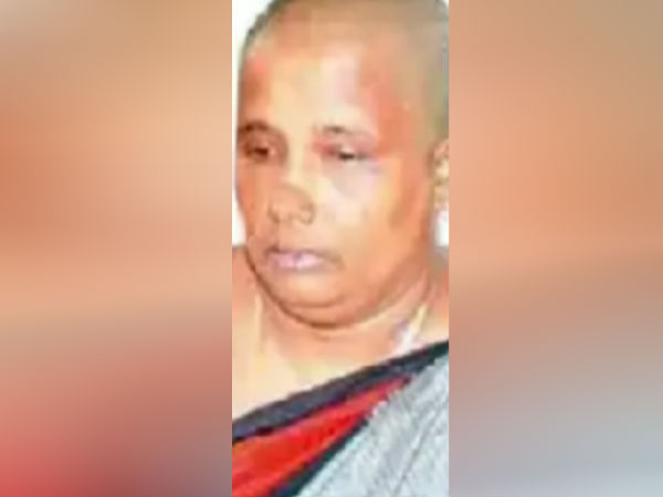 மொட்டை தலை தங்கம் 