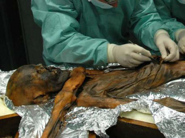 அதிக கொழுப்பு: