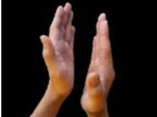 வாய் விட்டு சிரிங்க: