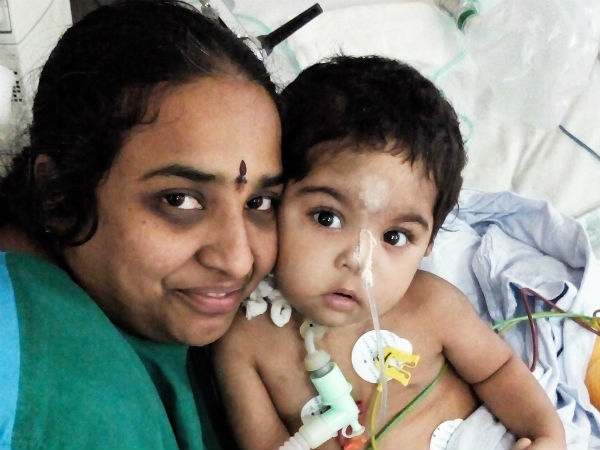 Even after 3 surgeries, this 1-year-old struggles for each breath 