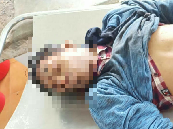 மரம் விழுந்து மாணவன் பலி 