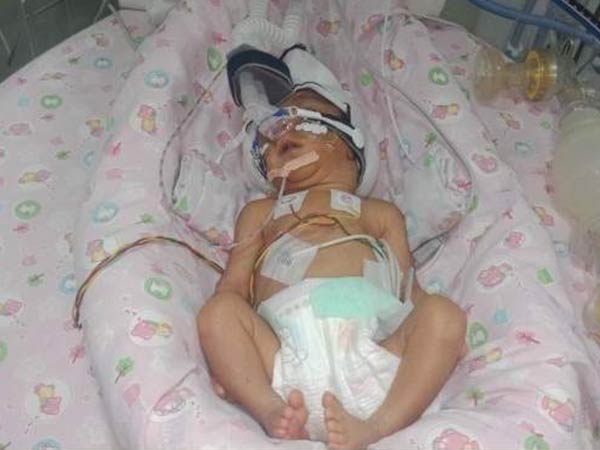 Driver’s premature baby girl waits for treatment in NICU