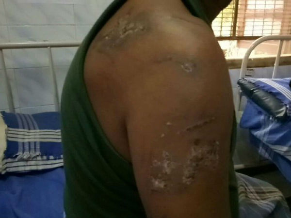  ஓயாமல் தொந்தரவு 