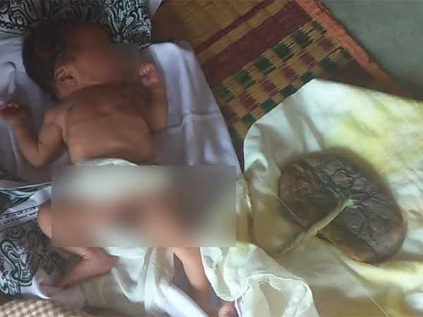 Delivery should be done in hospitals: Govt.Dr.Malathi 