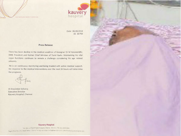 பின்னடைவு 