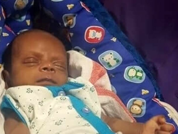  Help Them: A Month Old Baby Struggles To Breathe Due To Heart Disease