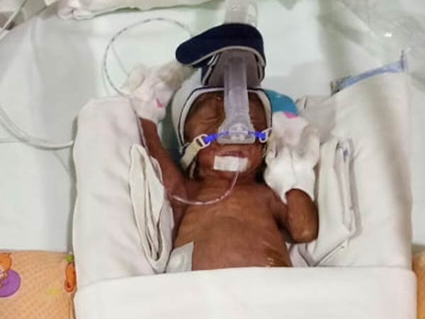 Premature baby born with a hole in heart needs your help Premature baby born with a hole in heart needs your help