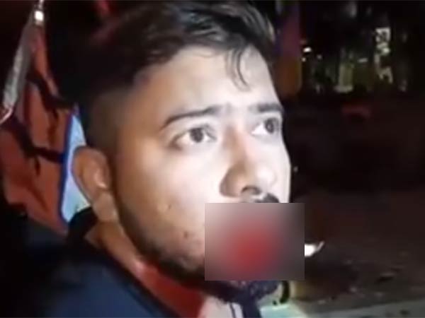 ஏன் கடித்தார் சுகன்யா ஏன் கடித்தார் சுகன்யா