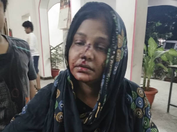 2 பேர் தாக்கினார்கள் 2 பேர் தாக்கினார்கள்