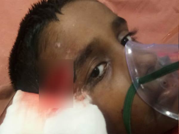  பின் பக்க மண்டை