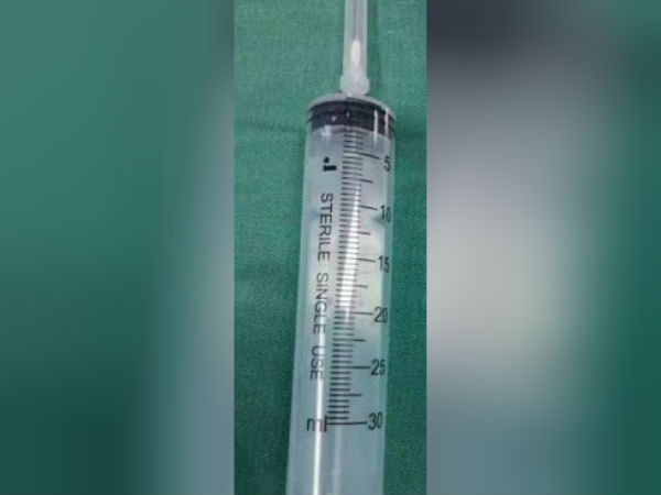 சிரமப்பட்டு ஆபரேஷன் சிரமப்பட்டு ஆபரேஷன்