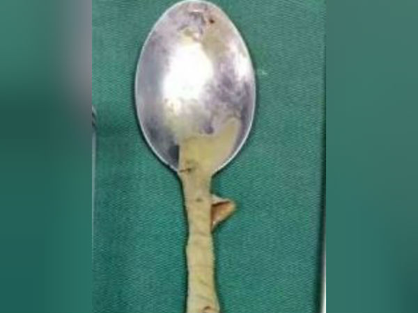 20 செ.மீ. நீள ஸ்பூன் 20 செ.மீ. நீள ஸ்பூன்