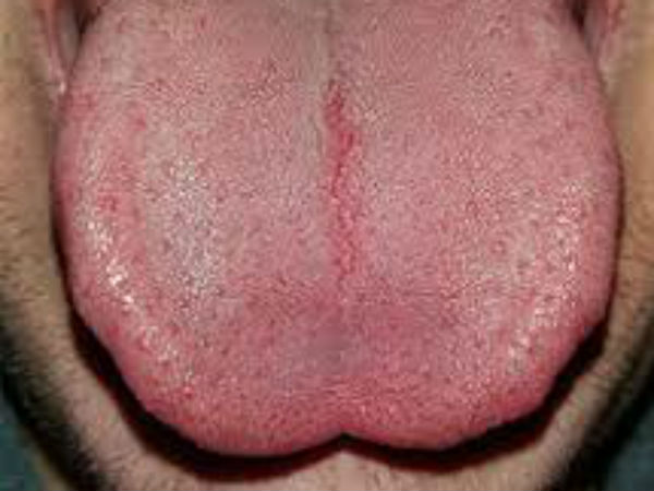 வலியால் அலறினார் 