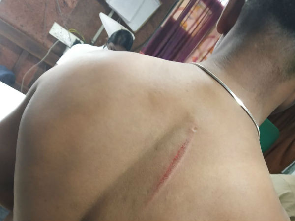 பைக்கில் தப்பினர் 