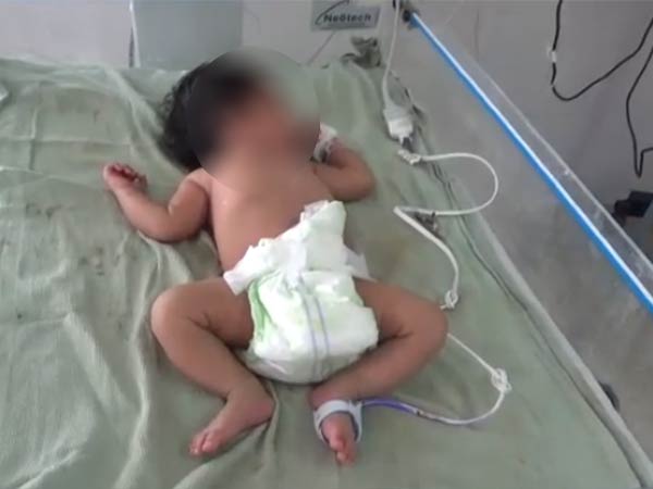 துணியால் சுற்றி இருந்தது 