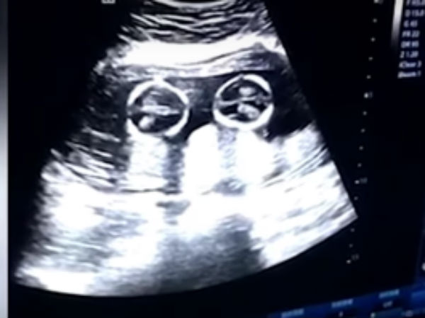 பாசப்பிணைப்பு 