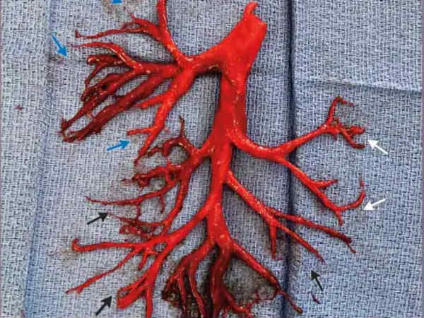 புரோக்கர்கள் 