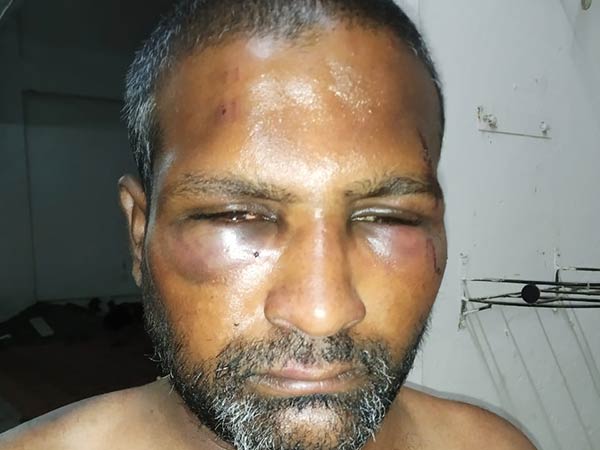 youth attacked by mlas brother 