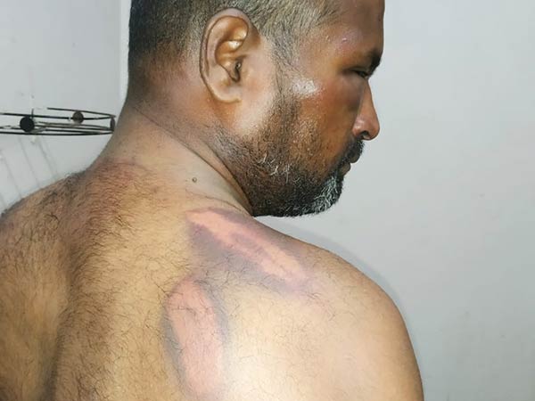 youth attacked by mlas brother 