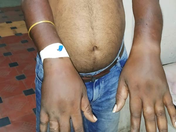 youth attacked by mlas brother 
