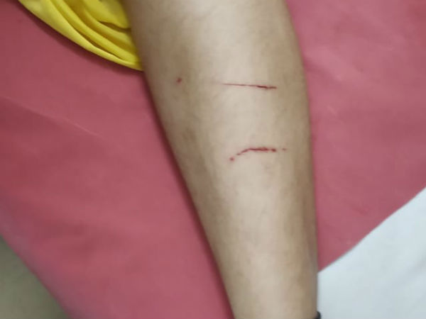 சிகிச்சை 