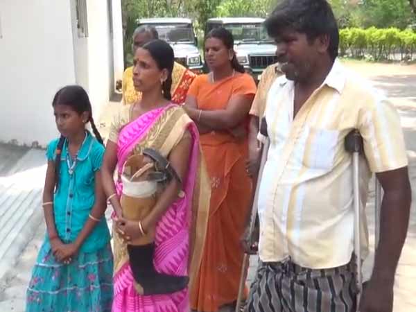 Physically Challenged person handovers his artificial leg 