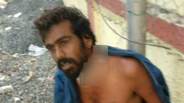 சிகிச்சை 