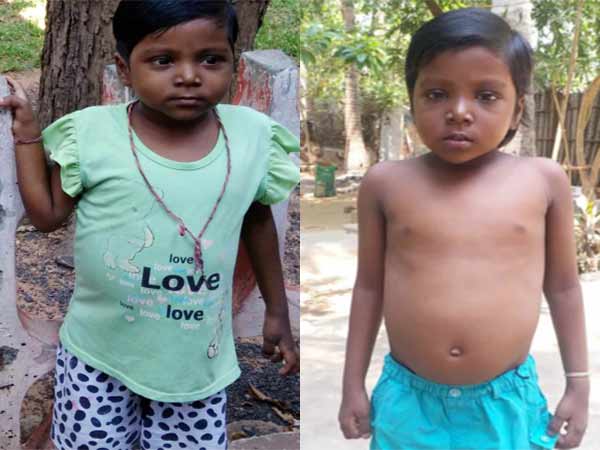 Please Save 6 years old baby Dhaniskha who needs an urgent liver transplant. Please Save 6 years old baby Dhaniskha who needs an urgent liver transplant.
