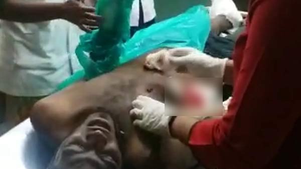 Bomb explodes in Puducherry, Rowdy Injured