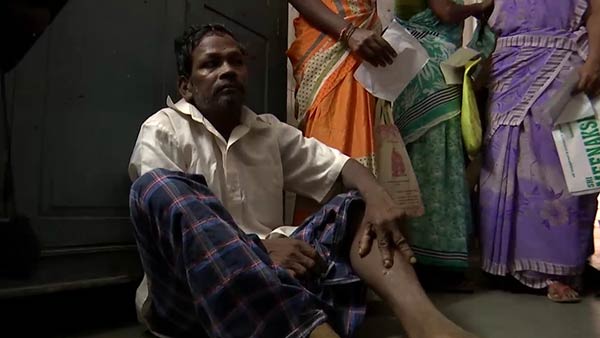 Over 30 people bitten by rabid dog..People panic in Puducherry