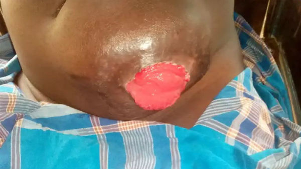 Help Mr.Joseph Vinayagamurthi from Srilanka for his operation 