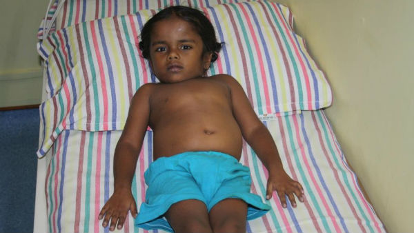 Support to Save 4 year old Monish from Heart Problem 