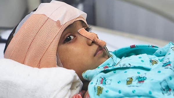 Help Drishti, Who Is Slowly Losing Her Eyesight due to tumor 