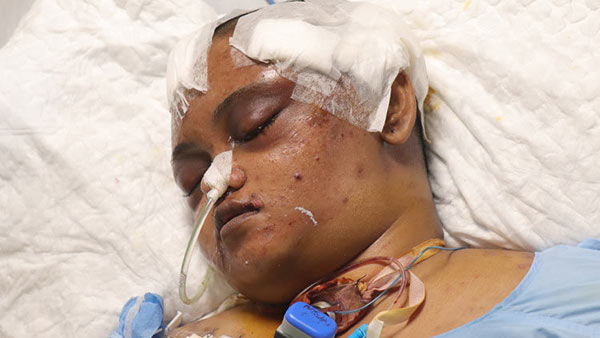You can save Mahalakshmi who is under treatment in ICU after met with a tragic accident